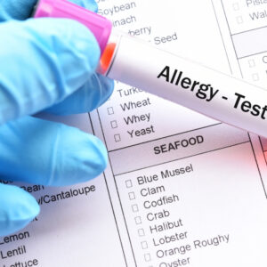 Detaylı Moleküler Alerji Testi (300)